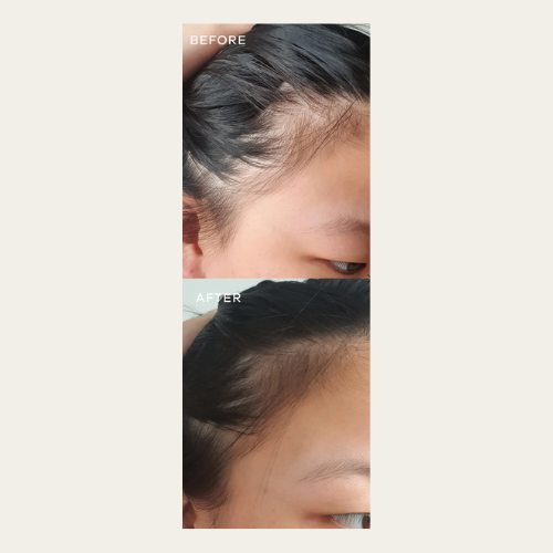 Vida Glow Hairology Capsules