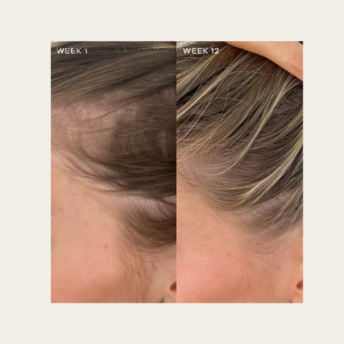 Vida Glow Hairology Capsules